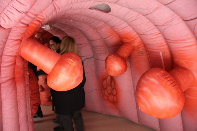 Colon gigante_02