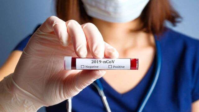coronavirus coronavirus asl roma 6