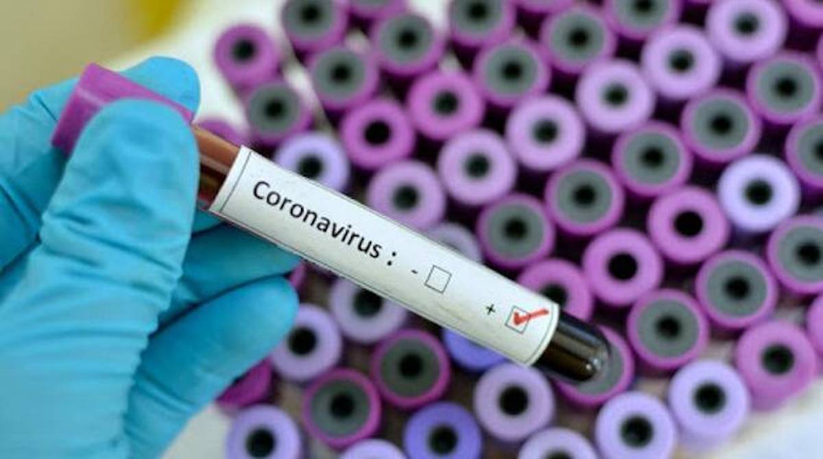 Coronavirus nel Lazio