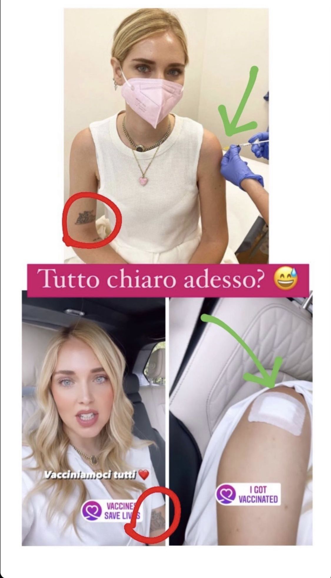 vaccino Chiara Ferragni 