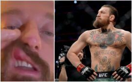 facchinetti-picchiato-conor-mcgregor