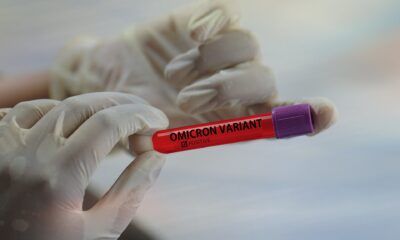 Coronavirus, i dati di oggi nel Lazio