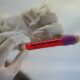 Coronavirus, i dati di oggi nel Lazio