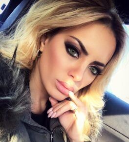 Elena Morali dopo i ritocchi estetici