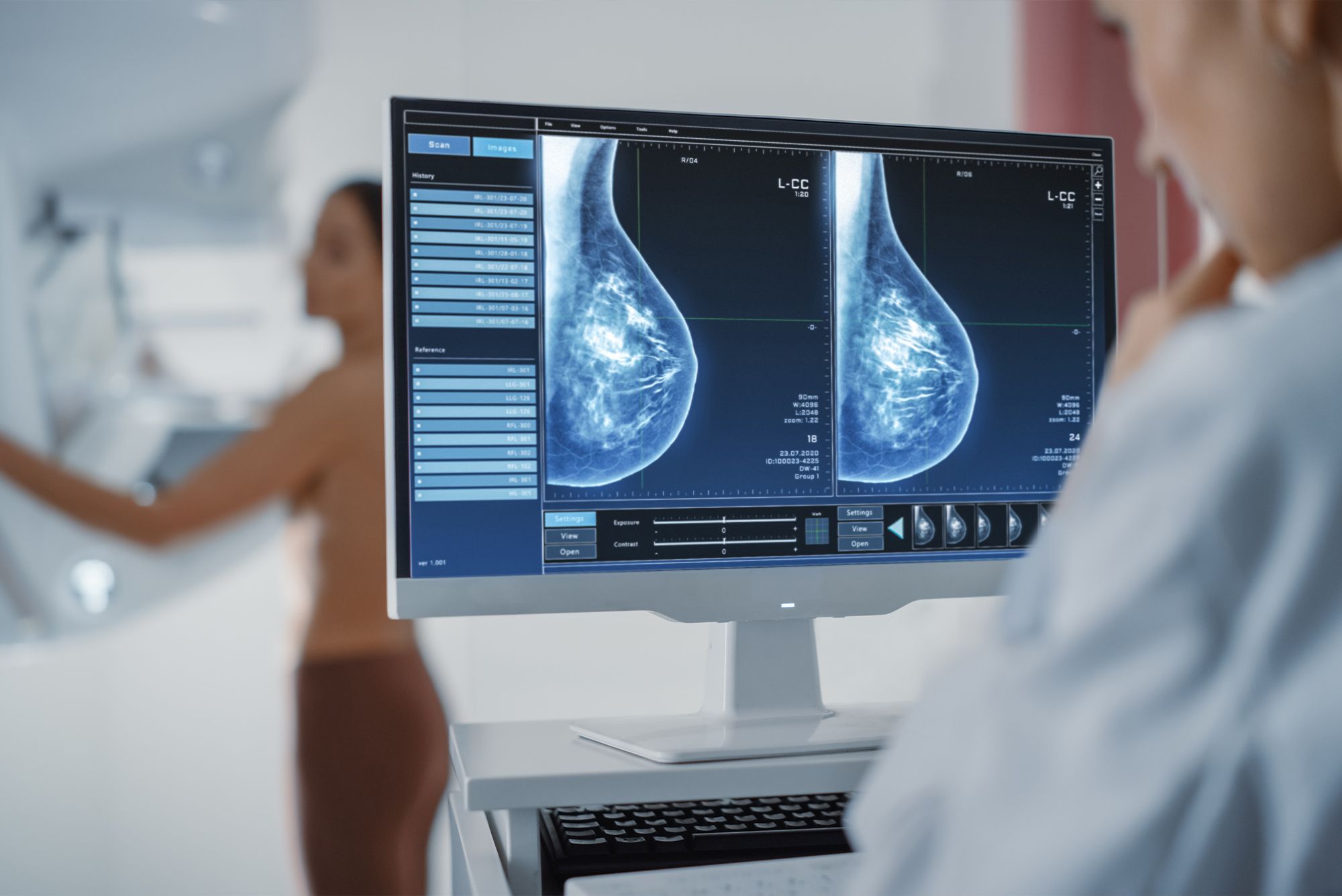 Mammografia Regione Lazio online