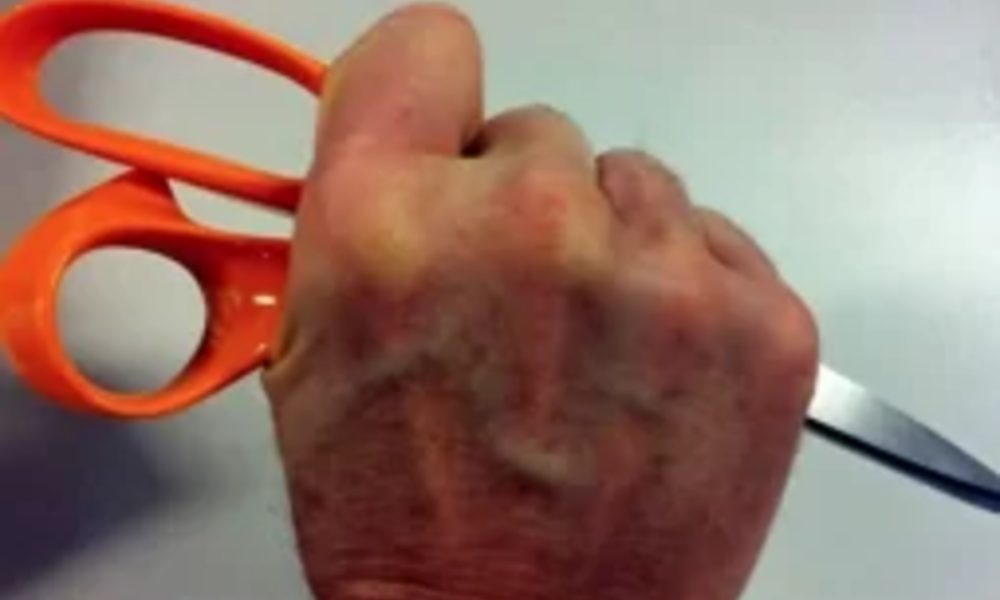 Agguato a Ostia, uomo ferito con le forbici: choc al mercato di via dell’Appagliatore Agguato a Ostia, uomo ferito con le forbici: choc al mercato di via dell’Appagliatore