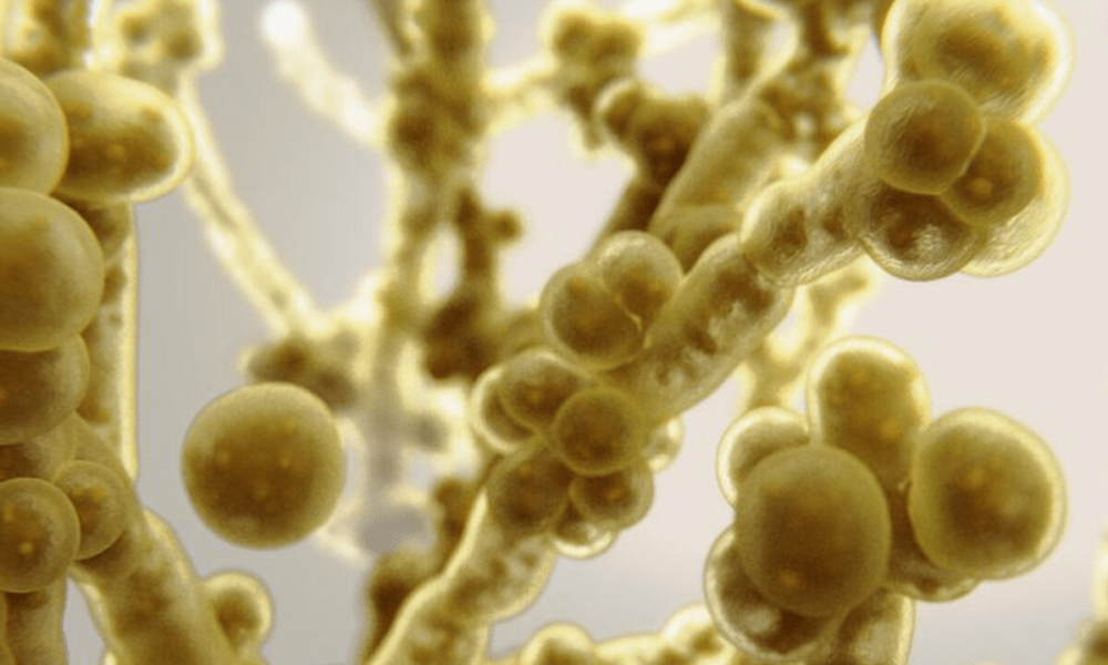 Candida auris 