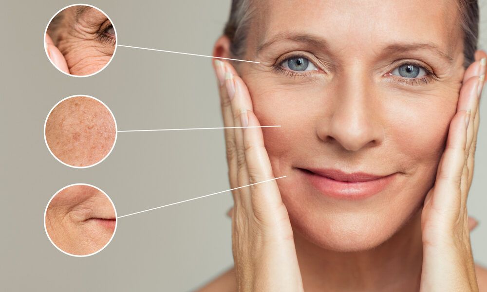 Medicina o chirurgia estetica per lifting viso: Quale scegliere?