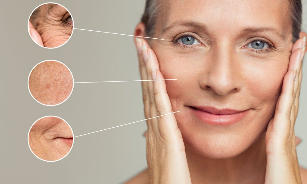 Medicina o chirurgia estetica per lifting viso: Quale scegliere? Medicina o chirurgia estetica per lifting viso: Quale scegliere?