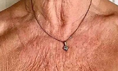 Rughe dal corpo