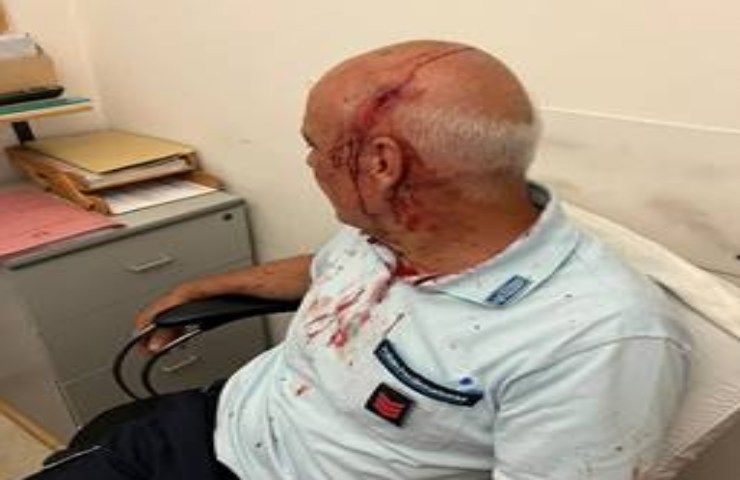 Un agente della penitenziaria dopo un'aggressione - www.IlCorrieredellacittà.com